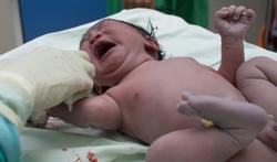 Hoe worden aangeboren aandoeningen bij babyâs opgespoord?