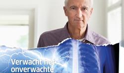 Verwacht het onverwachte: pneumonie kan ons allemaal treffen