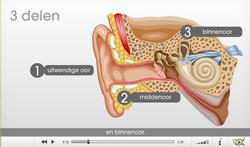 Video: Wat is een cochleair implantaat?
