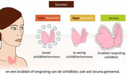 Video: Schildklierproblemen