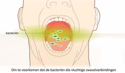 Video: Slechte adem