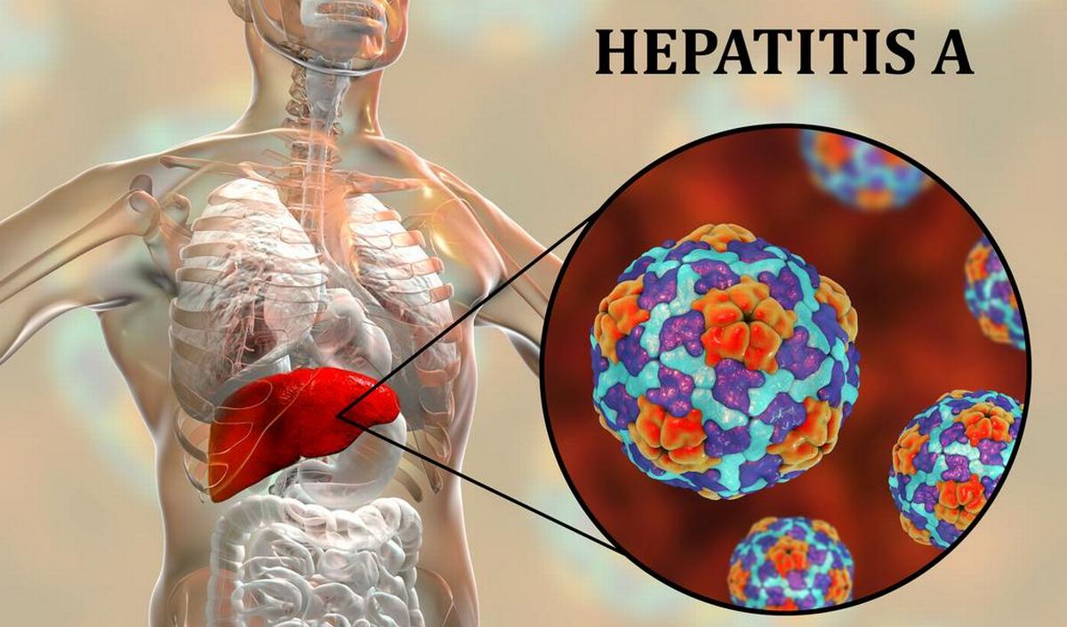 Hoe gevaarlijk is hepatitis A?